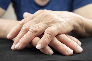 Arthritis Pain Relief Arthritis Pain Relief