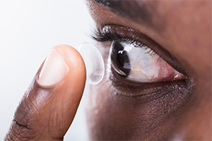 Contact Lenses Contact Lenses