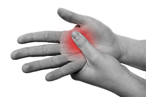 Rheumatoid Arthritis Rheumatoid Arthritis